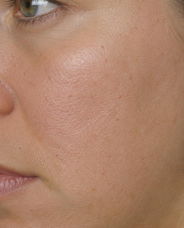 Before reference image, awaiting the clinic's own photographs